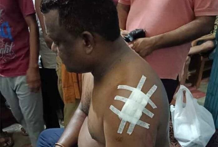 नगर पंचायत उपाध्यक्ष विजय सूर्यवंशी पर जानलेवा हमला नगर पंचायत उपाध्यक्ष विजय सूर्यवंशी पर जानलेवा हमला kshititech