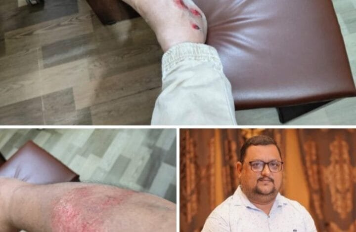 सड़क दुर्घटना में बाल- बाल बचे जनर्लिस्ट वेलफेयर यूनियन के प्रदेश अध्यक्ष अमित गौतम , 9 दिसंबर के अधिवेशन हेतु प्रदेश अध्यक्ष गौतम ने करी पत्रकार साथियों को जांजगीर पहुंचने की अपील सड़क दुर्घटना में बाल- बाल बचे जनर्लिस्ट वेलफेयर यूनियन के प्रदेश अध्यक्ष अमित गौतम , 9 दिसंबर के अधिवेशन हेतु प्रदेश अध्यक्ष गौतम ने करी पत्रकार साथियों को जांजगीर पहुंचने की अपील kshititech