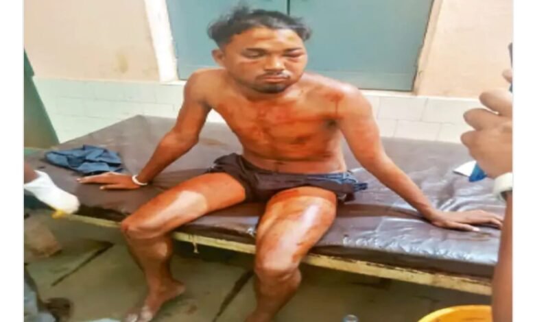 लड़की से बात करते देखा तो कुत्ते का बेल्ट पहनाकर घुमाया-पीटा, सुई चुभोई, निर्वस्त्र कर वीडियो बनाया लड़की से बात करते देखा तो कुत्ते का बेल्ट पहनाकर घुमाया-पीटा, सुई चुभोई, निर्वस्त्र कर वीडियो बनाया kshititech